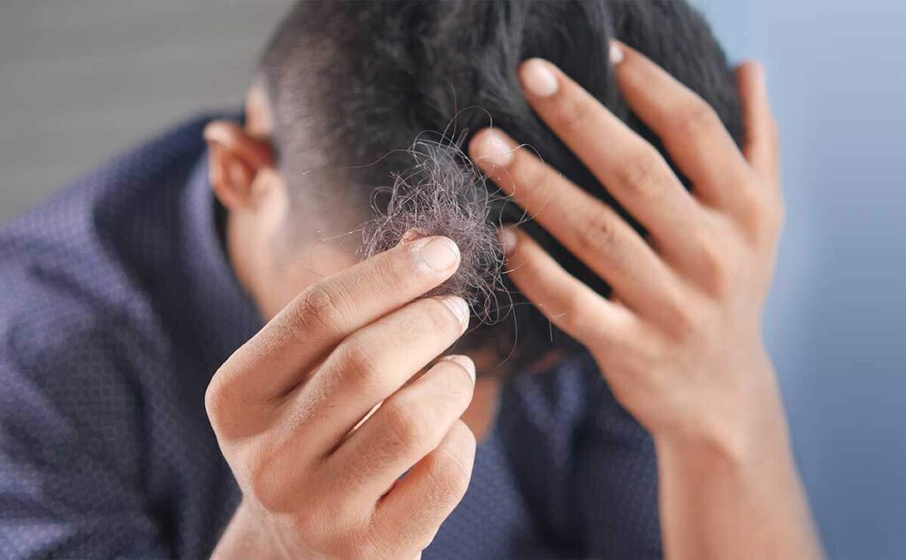 How-To-Stop-Hair-Fall-From-Front-Stop-Hair-Falling-Out-From-Stress